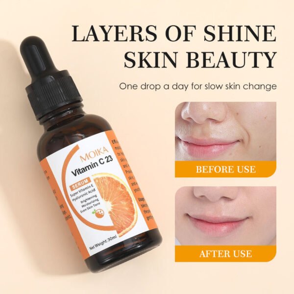MOIKA Private Label Vitamin C Kojic Acid Skincare Serum Skin Whitening Facial Serum for Dark Spots Remover Wholesale OEM - Image 6