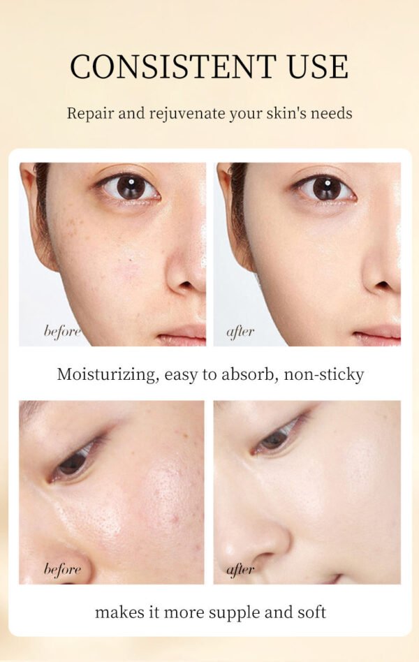 Moika HOT SALES Whitening 6 piece set whitening spot, anti-wrinkle, light lines, soothing and moisturizing - Image 2