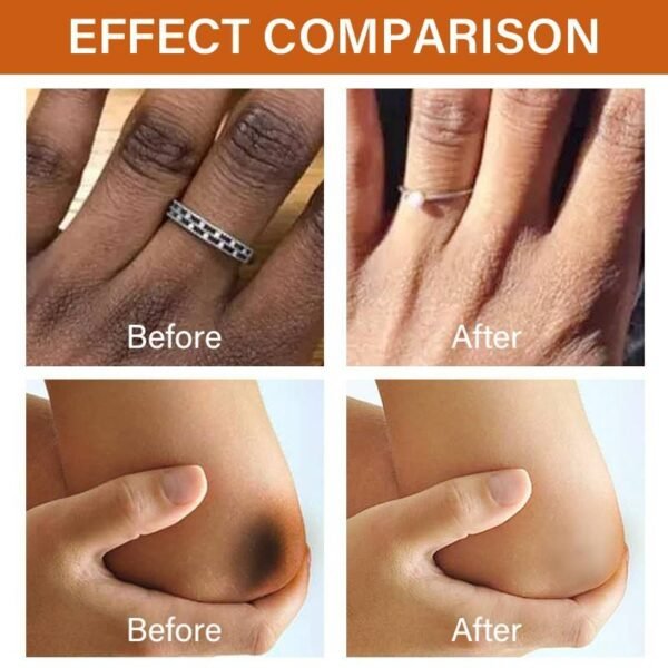 MOIKA Private Label 50ml 7 Days Whitening Dark Knuckle Vitamin C Dispelling Black Body Serum Whitening Essence - Image 3
