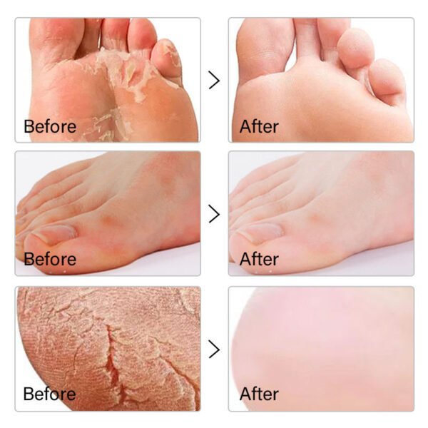 Moika Skin Naturals | Foot Mask | Aloe Vera | Orange | Rose, (Pack Of 3) |40Ml - Image 4