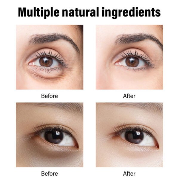 Moika Face Whitening Retinol Cream Dark Spot Removing Skin Lightening Cream Vitamin C E Moisturizing Face Creams for Women - Image 4