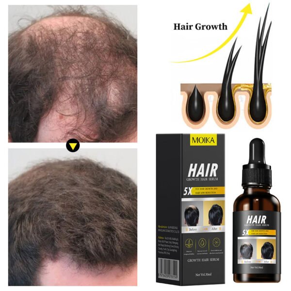 MOIKA Private Label 100% Natural Organic Rosemary Castor Almond Oil Men Women Scalp Care Serum Hair Treatment Growth Oil - Image 3