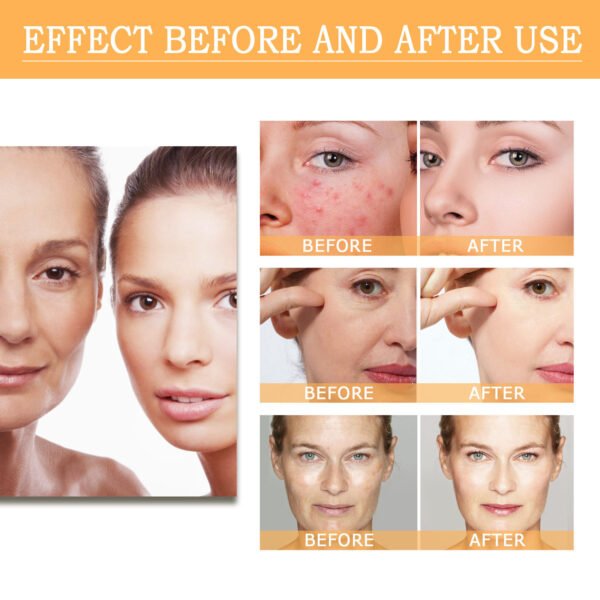Moika ordinay Glycolic Acid 7% Toning Solution 240ml Fruit acid toner 7% glycolic acid serum Blackhead and cutin removing serum - Image 6