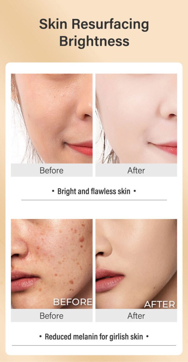 MOIKA Private Label Turmeric Repairing Face Cream brightening ,Moisturizing And Hydrating Face Cream Reduce Acne And Dark Spots - Image 4