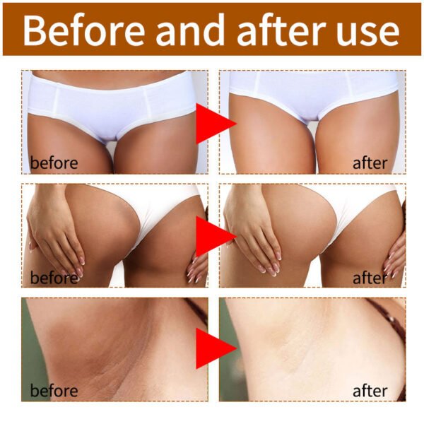 MOIKA 7Days Strong Whitening Cream Private Parts Dark Knees Knuckles Elbows Armpit Bleaching Skin Whitening Cream - Image 5