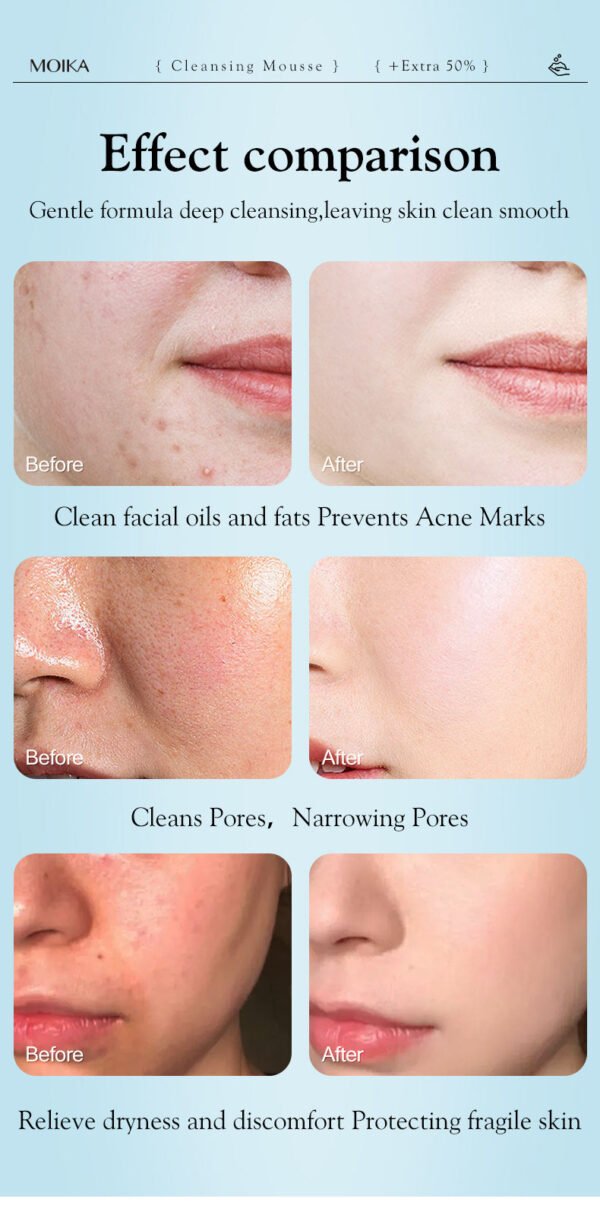 MOIKA OEM Natural Organic Vc Foam Face Wash Anti Aging Whitening Deep Cleansing Oil Control Vitamin Milk Foaming Facial Cleanser - Image 10