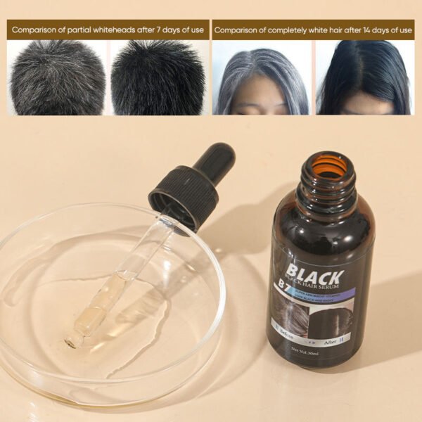MOIKA OEM Organic Castor Oil Serum Bulk Cold Pressed Hexane Free Pure Natural Jamaica Black Castor Oil for Hair - Image 5