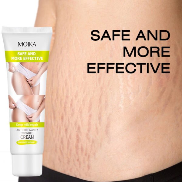 MOIKA Strong Effective Acne Scar Removal Cream Pimples Stretch Marks Face Gel Tummy Tuck Tightening Stretch Mark Removal Cream - Image 3