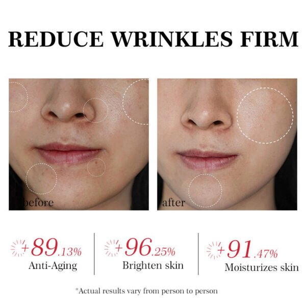 MOIKA New Best Face Whitening Cream Skin Moisturizing Permanent Glowing Skin Cream Facial Retinol Anti-Aging Whitening Cream - Image 4