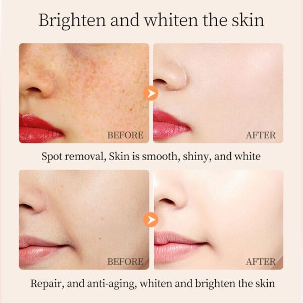 MOIKA Remove Dark Spots Essential Oil Anti Wrinkle Face Serum Therapeutic Acne Shrink Pores Whitening Moisturizing Skin Care - Image 4