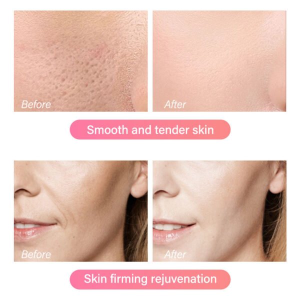 MOIKA 100%Best Selling factory cosmetic Moisturizing Nourishing Anti-Aging Essence beauty Whitening for Face Serum - Image 6