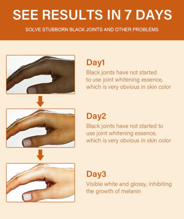 MOIKA Private Label 50ml 7 Days Whitening Dark Knuckle Vitamin C Dispelling Black Body Serum Whitening Essence - Image 6