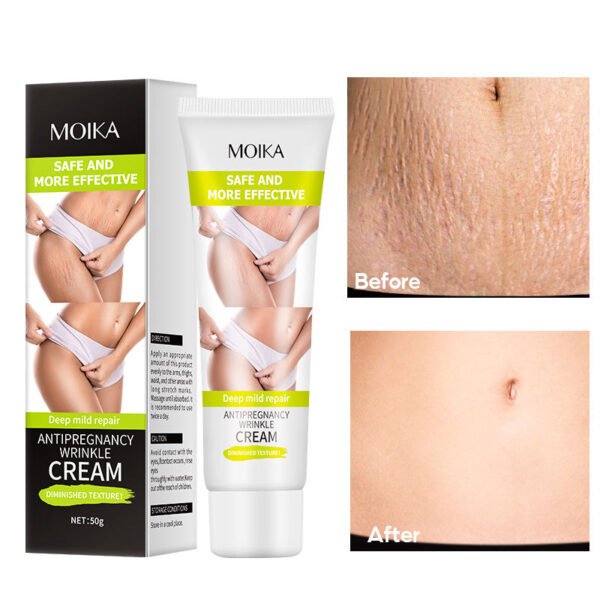 MOIKA Strong Effective Acne Scar Removal Cream Pimples Stretch Marks Face Gel Tummy Tuck Tightening Stretch Mark Removal Cream