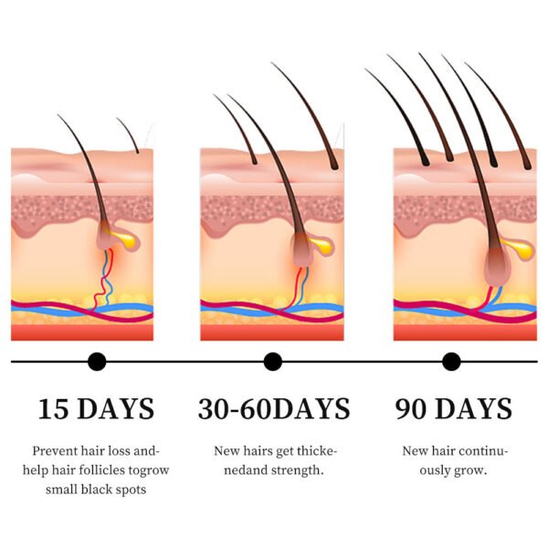 MOIKA Private Label 100% Natural Organic Rosemary Castor Almond Oil Men Women Scalp Care Serum Hair Treatment Growth Oil - Image 7